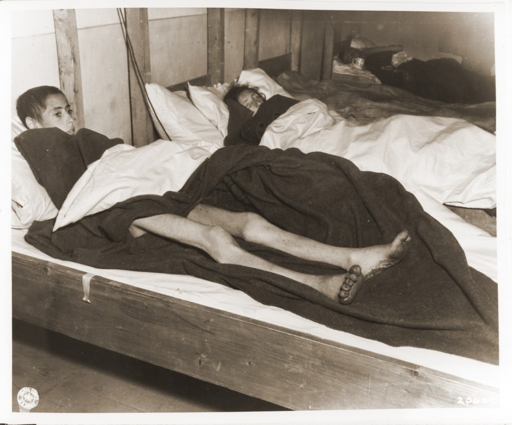 A series of beds line the wall. The woman in the bed closest to the camera has a shaved head, severely thin legs and dark injured feet.