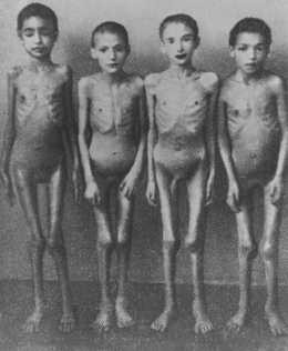 Victimes des expériences médicales du Dr Josef Mengele à Auschwitz-Birkenau. [LCID: 5961]