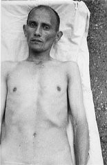 Un ex prigioniero Rom (Zingaro) che era stato sottoposto dai Nazisti a esperimenti medici per rendere potabile l'acqua di mare. Campo di concentramento di Dachau, Germania, 1944.