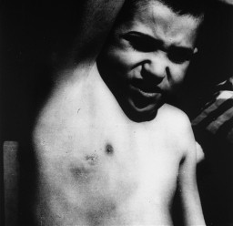 A Jewish child is forced to show the scar left after SS physicians removed his lymph nodes. [LCID: 78743l]