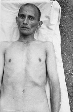 A Romani (Gypsy) victim of Nazi medical experiments to make seawater safe to drink. [LCID: 78683]